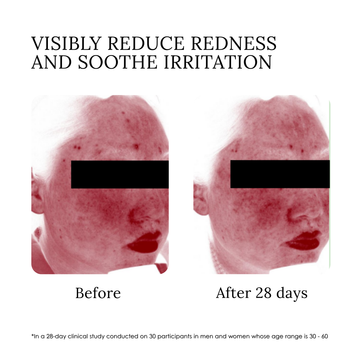 Rose Revitalizing Treatment Mask 3.0 - Skincare Lab
