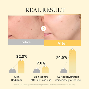 medicube Kojic Acid Turmeric Brightening Gel Mask 28g-4