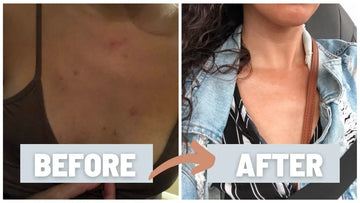 Unblurred Calming & Clearing Beauty Serum