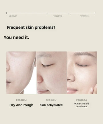 10pcs Pro-Xylane Anti-Wrinkle Lyophilized Serum High Concentration Anti-Aging Firming Face Essence for Deep Wrinkles