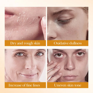 5pcs BIOAOUA Rice Raw Whitening Set Brighten Hydrating Moisturize Soothing Facial Cleanser+toner+essence+lotion+cream Skincare