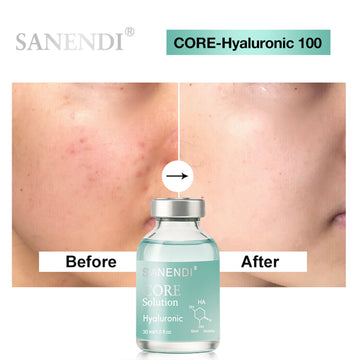 Sanendi CORE New EXO+ Hyaluronic Acid Facial Moisturizing and Hydrating Skin Care Skin Soothing Age-defying Serum Beauty Salon