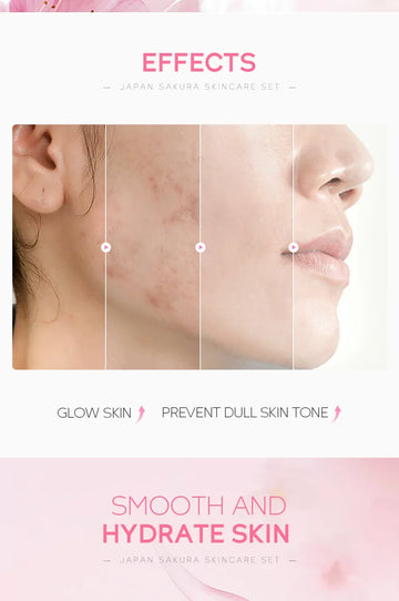 Sakura Kit Skin Care Sets Moisturizing and Reducing Fine Lines Cleansing Pore Product 5-Piece Korean Christmas Gift Set