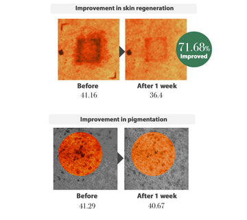 Mediheal Madecassoside Essential Mask 24g